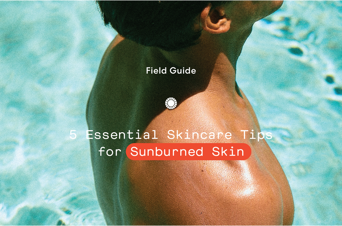 Field Guide: 5 Essential Tips for Treating Sunburned Skin
